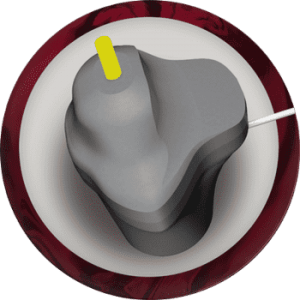 Radical Katana Slash noyau